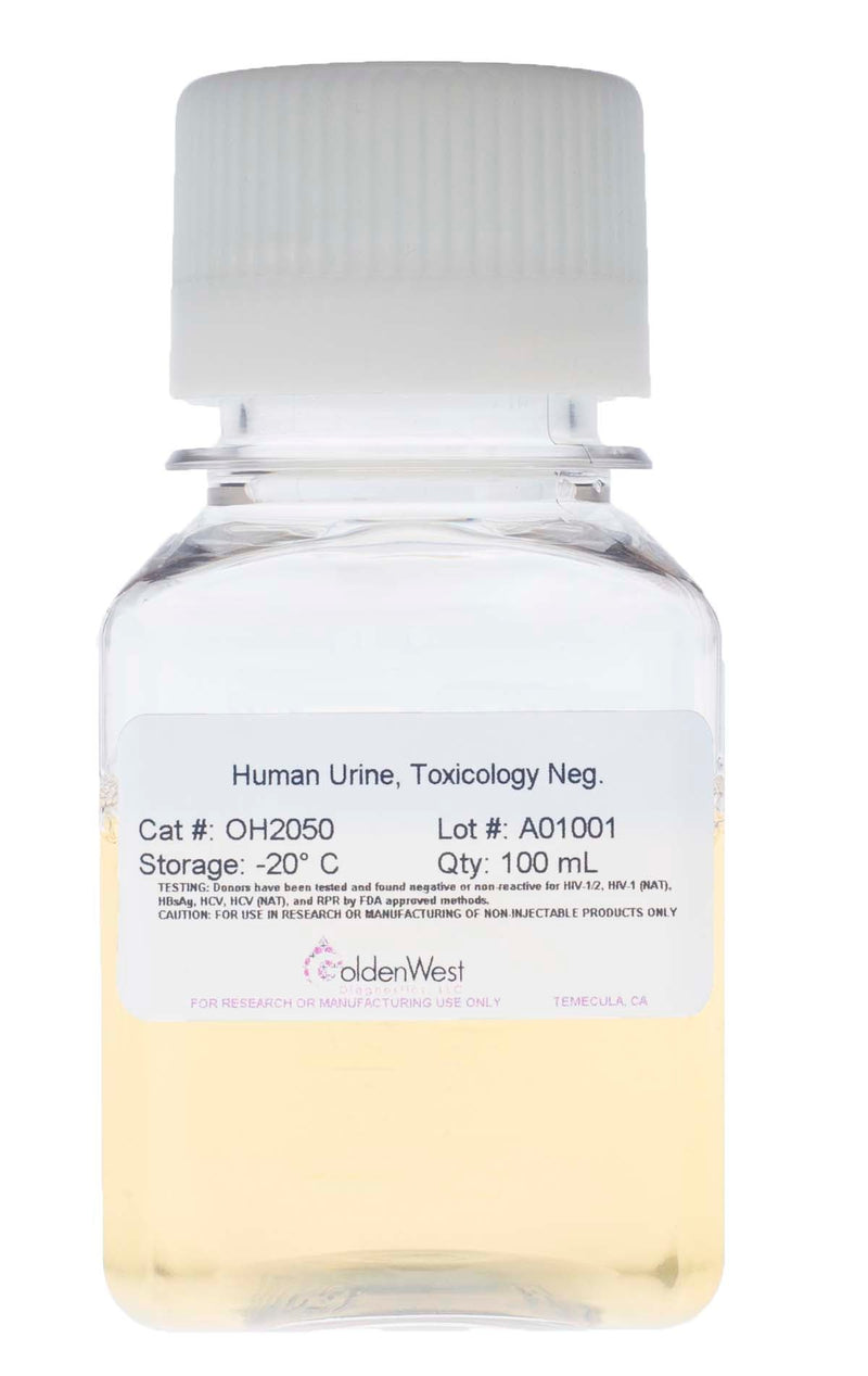 Golden West Diagnostics, LLC Toxicology, Saliva and Urine Human Urine, Toxicology Neg. OH2050