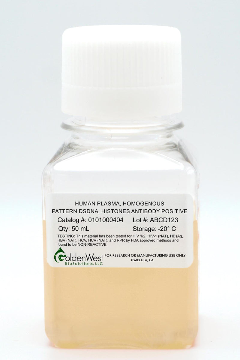 Human Plasma, Homogenous Pattern dsDNA, Histones Antibody Positive