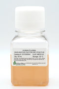 Human Plasma, Rheumatoid Factor (RF) Positive