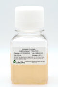 Human Plasma, Ribosomal P Positive
