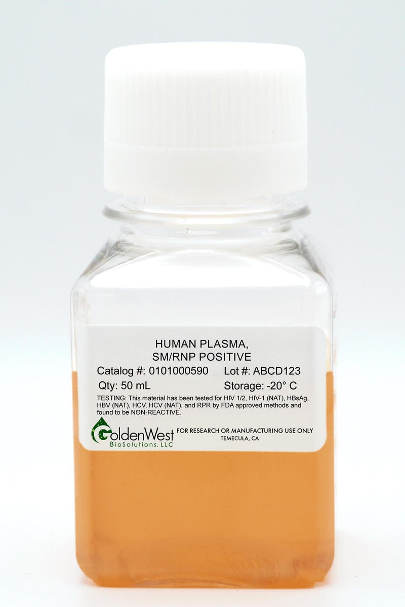 Human Plasma, Sm/RNP Positive