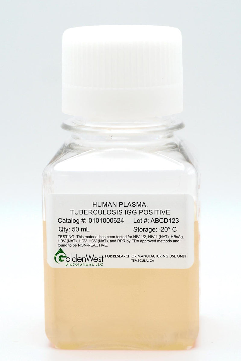 Human Plasma, Tuberculosis IgG Positive
